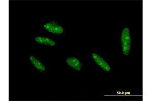 Immunofluorescence of purified MaxPab antibody to KLF15 on HepG2 cell. (KLF15 抗体  (AA 1-416))