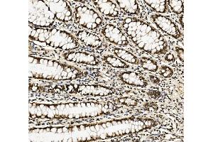 IHC analysis of DDX5 using anti-DDX5 antibody (ABIN7602561). (DDX5 抗体  (AA 85-328))