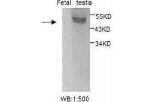 Image no. 1 for anti-Estrogen Receptor 2 (ESR2) antibody (ABIN790795) (ESR2 抗体)