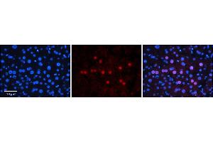 Rabbit Anti-GNL3L Antibody  Catalog Number: ARP58798_P050 Formalin Fixed Paraffin Embedded Tissue: Human Adult Liver  Observed Staining: Nuclear in hepatocytes, moderate signal, low tissue distribution Primary Antibody Concentration: 1:100 Secondary Antibody: Donkey anti-Rabbit-Cy3 Secondary Antibody Concentration: 1:200 Magnification: 20X Exposure Time: 0. (GNL3L 抗体  (N-Term))