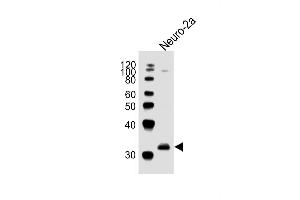 Anti-EN2Antibody (C-term)at 1:1000 dilution + Neuro-2a whole cell lysates Lysates/proteins at 20 μg per lane. (EN2 抗体  (C-Term))
