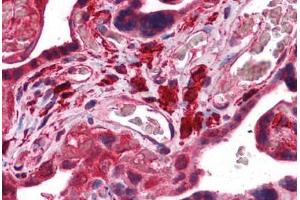 Human Placenta: Formalin-Fixed, Paraffin-Embedded (FFPE) (Fukutin 抗体  (AA 272-456))