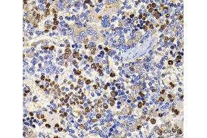Immunohistochemistry of paraffin-embedded Rat spleen using UBASH3B Polyclonal Antibody at dilution of 1:100 (40x lens). (UBASH3B 抗体)