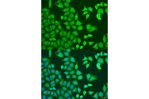 Immunofluorescence analysis of U2OS cells using CAPZB antibody. (CAPZB 抗体  (AA 1-272))