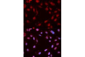 Immunofluorescence analysis of MCF7 cell using Phospho-CHEK1-S280 antibody. (CHEK1 抗体  (pSer280))