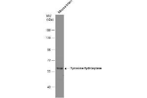 WB Image Mouse tissue extract (50 μg) was separated by 7. (Tyrosine Hydroxylase 抗体)