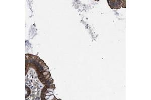 Immunohistochemical staining of human colon with TRIP4 polyclonal antibody  shows cytoplasmic positivity in glandular cells. (TRIP4 抗体)