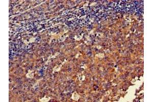 Immunohistochemistry of paraffin-embedded human tonsil tissue using ABIN7150570 at dilution of 1:100 (DOK3 抗体  (AA 1-146))