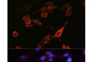Immunofluorescence (IF) image for anti-Solute Carrier Family 3 (Activators of Dibasic and Neutral Amino Acid Transport), Member 2 (SLC3A2) antibody (ABIN7010781)