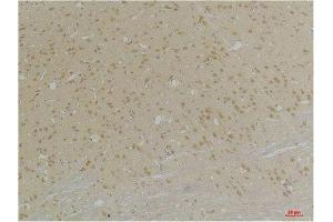 Immunohistochemistry (IHC) analysis of paraffin-embedded Rat Brain Tissue using GABA A Receptor alpha4 Rabbit Polyclonal Antibody diluted at 1:200. (GABRA4 抗体)