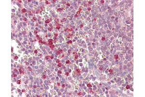 Immunohistochemistry (IHC) image for anti-Sirtuin 3 (SIRT3) (C-Term) antibody (ABIN6749702)