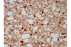 IHC image of ABIN7155695 diluted at 1:300 and staining in paraffin-embedded human brain tissue performed on a Leica BondTM system. (GBX2 抗体  (AA 65-248))