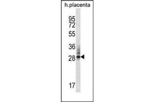 Western blot analysis of DNAJC27 / RBJ Antibody (N-term) in human placenta tissue lysates (35ug/lane). (DNAJC27 抗体  (N-Term))