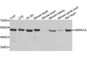 Western blot analysis of extracts of various cell lines, using ADRA1A antibody. (alpha 1 Adrenergic Receptor 抗体  (AA 346-475))