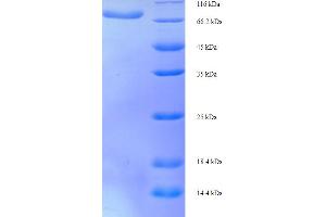 D2HGDH Protein (AA 14-521) (His-SUMO Tag)