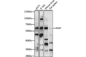 Western blot analysis of extracts of various cell lines, using HHAT antibody (ABIN7267598) at 1:1000 dilution. (HHAT 抗体  (AA 1-100))