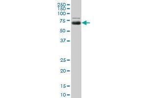 MGAT4A monoclonal antibody (M01), clone 8C5. (MGAT4A 抗体  (AA 436-535))