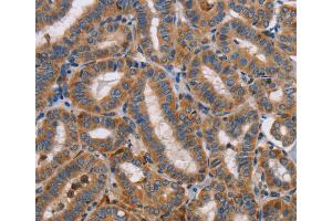 Immunohistochemistry (IHC) image for anti-Toll-Like Receptor 8 (TLR8) antibody (ABIN2422737) (TLR8 抗体)