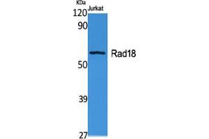 Western Blot (WB) analysis of specific cells using Rad18 Polyclonal Antibody. (RAD18 抗体  (Internal Region))