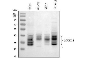 Western blot analysis of MPZL1 using anti-MPZL1 antibody (ABIN7601496).