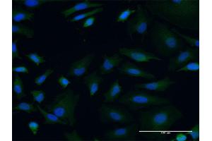 Immunofluorescence of monoclonal antibody to POLRMT on HeLa cell. (POLRMT 抗体  (AA 1121-1230))