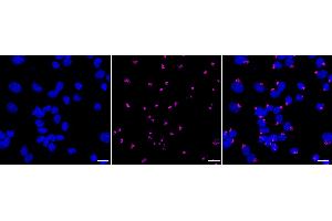 Immunocytochemical staining of Hela cells with Golgi reassembly stacking protein 1 antibody (ABIN7798795), 1:1,000). (Recombinant GORASP1 抗体)