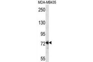 Western Blotting (WB) image for anti-Dishevelled Segment Polarity Protein 1 (DVL1) antibody (ABIN5016275) (DVL1 抗体)