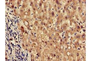 Immunohistochemistry of paraffin-embedded human liver tissue using ABIN7173617 at dilution of 1:100 (Tryptophan Hydroxylase 2 抗体  (AA 44-225))