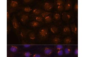 Immunofluorescence analysis of C6 cells using B3GNT4 Polyclonal Antibody at dilution of 1:100. (B3GNT4 抗体)