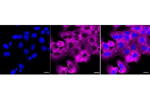 Immunocytochemical staining of HT- cells with LPP antibody (ABIN7799277), 1:1,000). (Recombinant LPP 抗体)