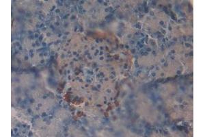 Immunohistochemistry (IHC) image for anti-Vasoactive Intestinal Peptide (Vip) (AA 28-159) antibody (ABIN7431698)