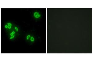 Immunofluorescence analysis of A549 cells, using TFIP8 antibody. (Cytokeratin 5 抗体  (Internal Region))