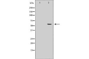 Western blot analysis of Cytochrome P450 19A1 Antibody expression in Human placenta tissue lysates. (Aromatase 抗体  (Internal Region))