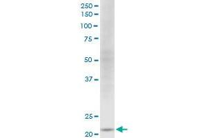NDUFV2 monoclonal antibody (M03), clone 1A10. (NDUFV2 抗体  (AA 150-249))