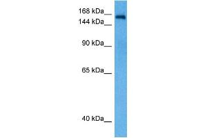 Host:  Rabbit  Target Name:  NCOA2  Sample Tissue:  Rat Brain  Antibody Dilution:  1ug/ml (NCOA2 抗体  (N-Term))