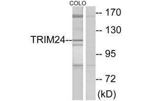 Western blot analysis of extracts from COLO cells, using TRIM24 antibody. (TRIM24 抗体  (C-Term))