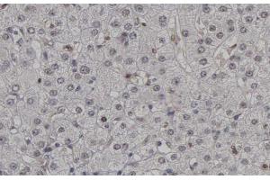 ABIN6267448 at 1/200 staining human Lymph nodes tissue sections by IHC-P. (CDK2 抗体  (pThr160))