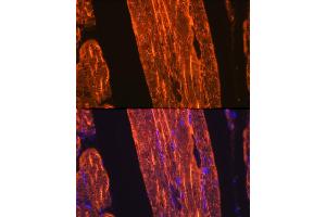 Immunofluorescence analysis of rat skeletal muscle using α-Actin-1  Rabbit mAb (ABIN3015986, ABIN3015987, ABIN1680683 and ABIN1680684) at dilution of 1:100 (40x lens). (Actin 抗体)