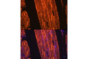 Immunofluorescence analysis of rat skeletal muscle using α-Actin-1  Rabbit mAb (ABIN3015986, ABIN3015987, ABIN1680683 and ABIN1680684) at dilution of 1:100 (40x lens). (Actin 抗体)