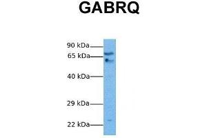 Host:  Rabbit  Target Name:  GABRQ  Sample Tissue:  Human Stomach Tumor  Antibody Dilution:  1. (GABRQ 抗体  (N-Term))