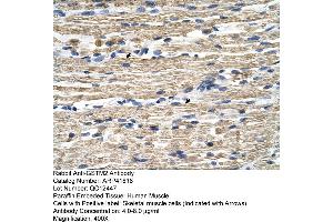 Rabbit Anti-GSTM2 Antibody  Paraffin Embedded Tissue: Human Muscle Cellular Data: Skeletal muscle cells Antibody Concentration: 4. (GSTM2 抗体  (N-Term))