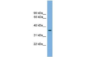 WB Suggested Anti-Foxf1a Antibody Titration: 0. (FOXF1 抗体  (Middle Region))