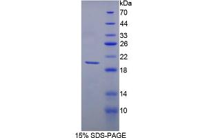 Image no. 1 for Matrix Metallopeptidase 13 (Collagenase 3) (MMP13) (AA 123-270) protein (His tag) (ABIN3209864)