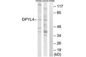 Western blot analysis of extracts from LOVO/HT-29 cells, using DPYSL4 Antibody. (DPYSL4 抗体  (AA 91-140))