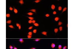 Immunofluorescence analysis of L929 cells using COMMD1 Polyclonal Antibody at dilution of 1:100. (COMMD1 抗体)
