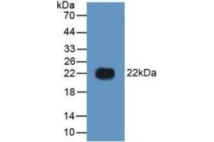 Western Blotting (WB) image for High Mobility Group Box 1 (HMGB1) ELISA Kit (ABIN6574155)