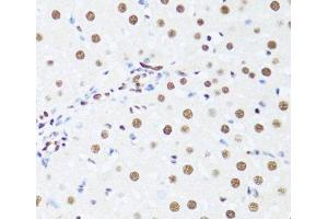 Immunohistochemistry of paraffin-embedded Rat liver using DDX39B Polyclonal Antibody at dilution of 1:100 (40x lens). (DDX39B 抗体)