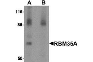 Western blot analysis of RBM35A in rat colon tissue lysate with RBM35A antibody at 0. (ESRP1 抗体  (N-Term))