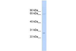 MRPL13 antibody used at 1 ug/ml to detect target protein.