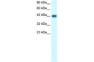 Western Blotting (WB) image for anti-Olfactory Receptor, Family 13, Subfamily C, Member 9 (OR13C9) (Middle Region) antibody (ABIN2777483)